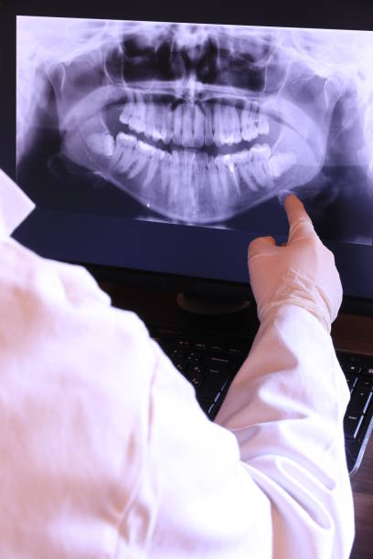 Best Emergency Dentist for Knocked-Out Tooth in Okemos, MI