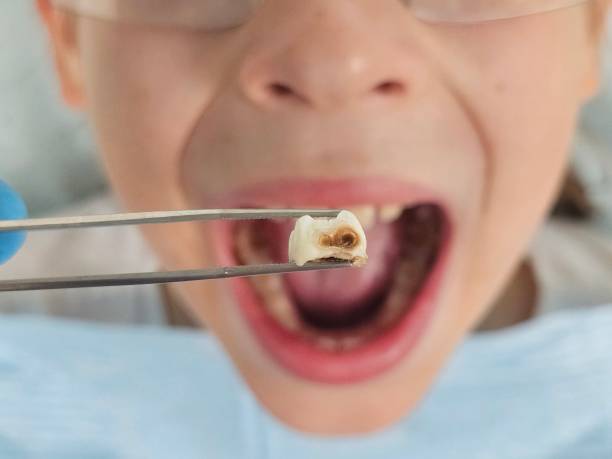 Best Pediatric Emergency Dentist in Okemos, MI