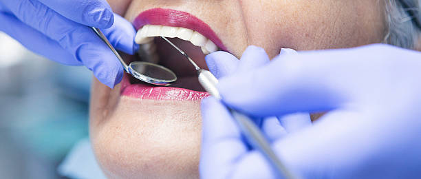 Best Emergency Dentist for Special Needs Patients in Okemos, MI